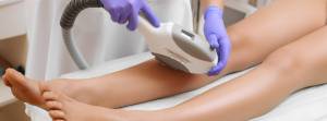 Laser treatment for hair removal is done quickly, with larger areas like legs & backs now being treated in less time.
