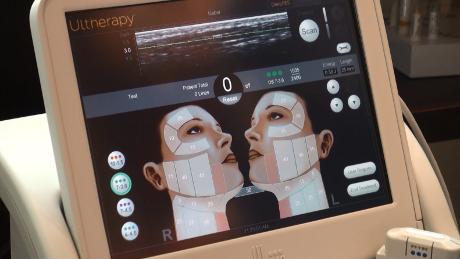 Ultherapy boosts the level of collagen in your skin, the key factor in maintaining elasticity & youthful-appearance.